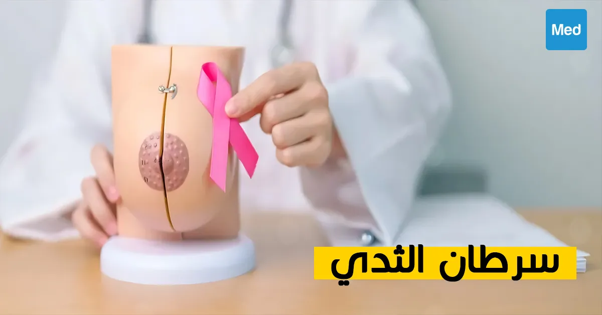 فهم شامل لسرطان الثدي: الأعراض والتشخيص والعلاج